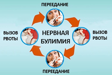 Лечение булимии в Красновишерске